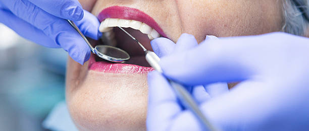 Best Emergency Wisdom Tooth Extraction in Shady Hills, FL