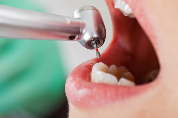 Best Emergency Treatment for Oral Infections in Shady Hills, FL